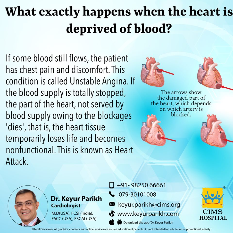 What exactly happens when the heart is deprived of blood?