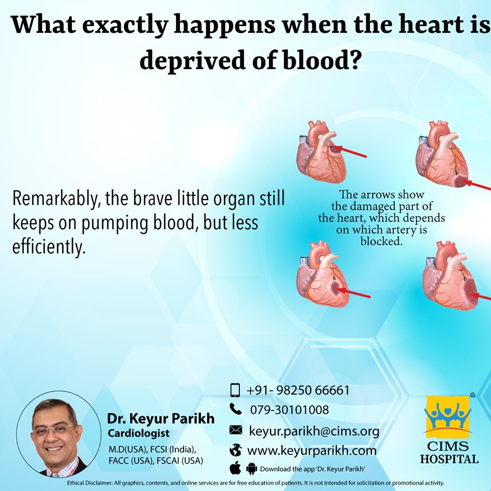 What exactly happens when the heart is deprived of blood?