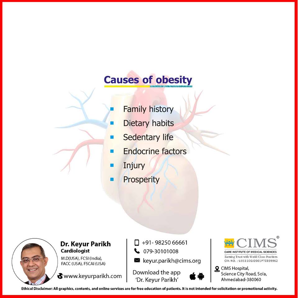 Causes of obesity.