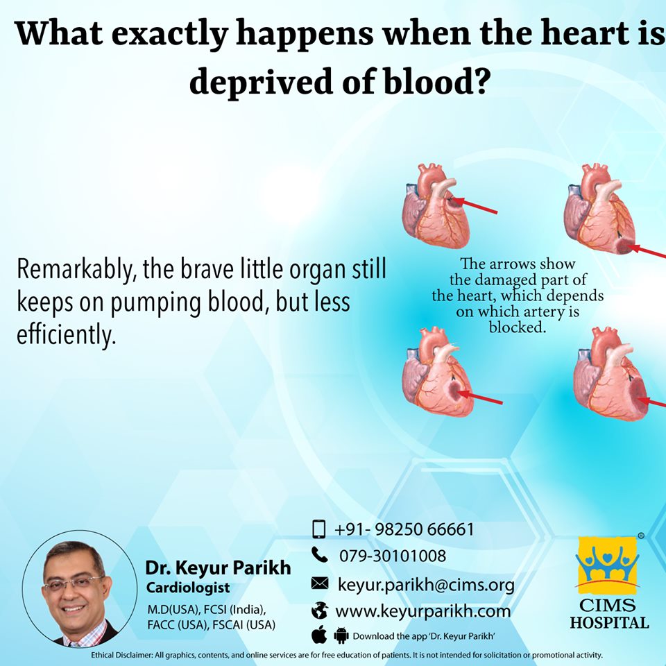 What exactly happens when the heart is deprived of blood? 